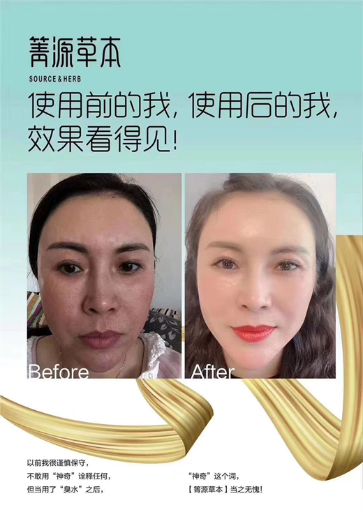 箐源草本臭水成分與功效