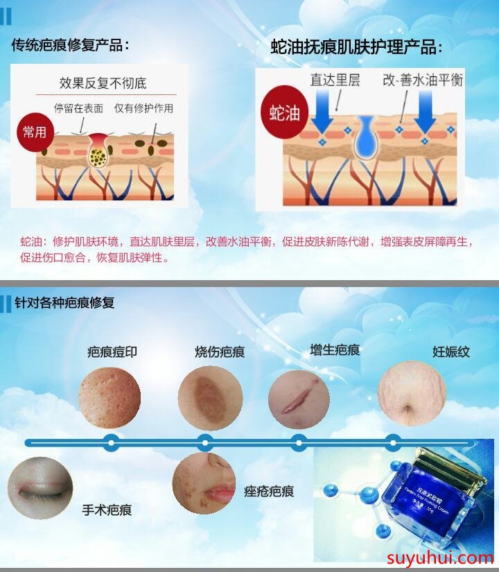 曼瑜天雅撫痕緊致霜成分功效及使用方法