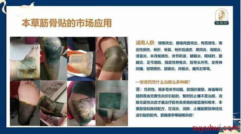 謝藥師本草筋骨貼的市場(chǎng)應(yīng)用及適用人群
